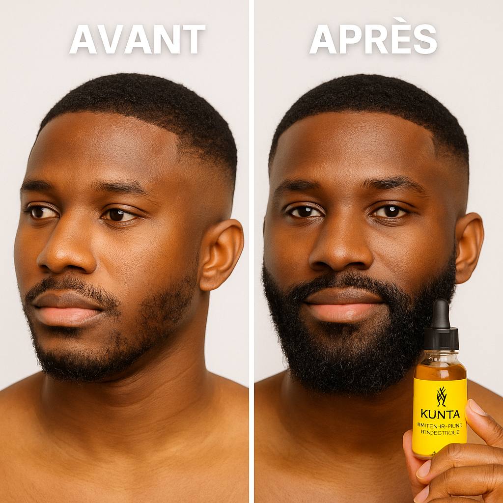 Kunta – Huile de Barbe Croissance ULTRA Rapide (30 ml)