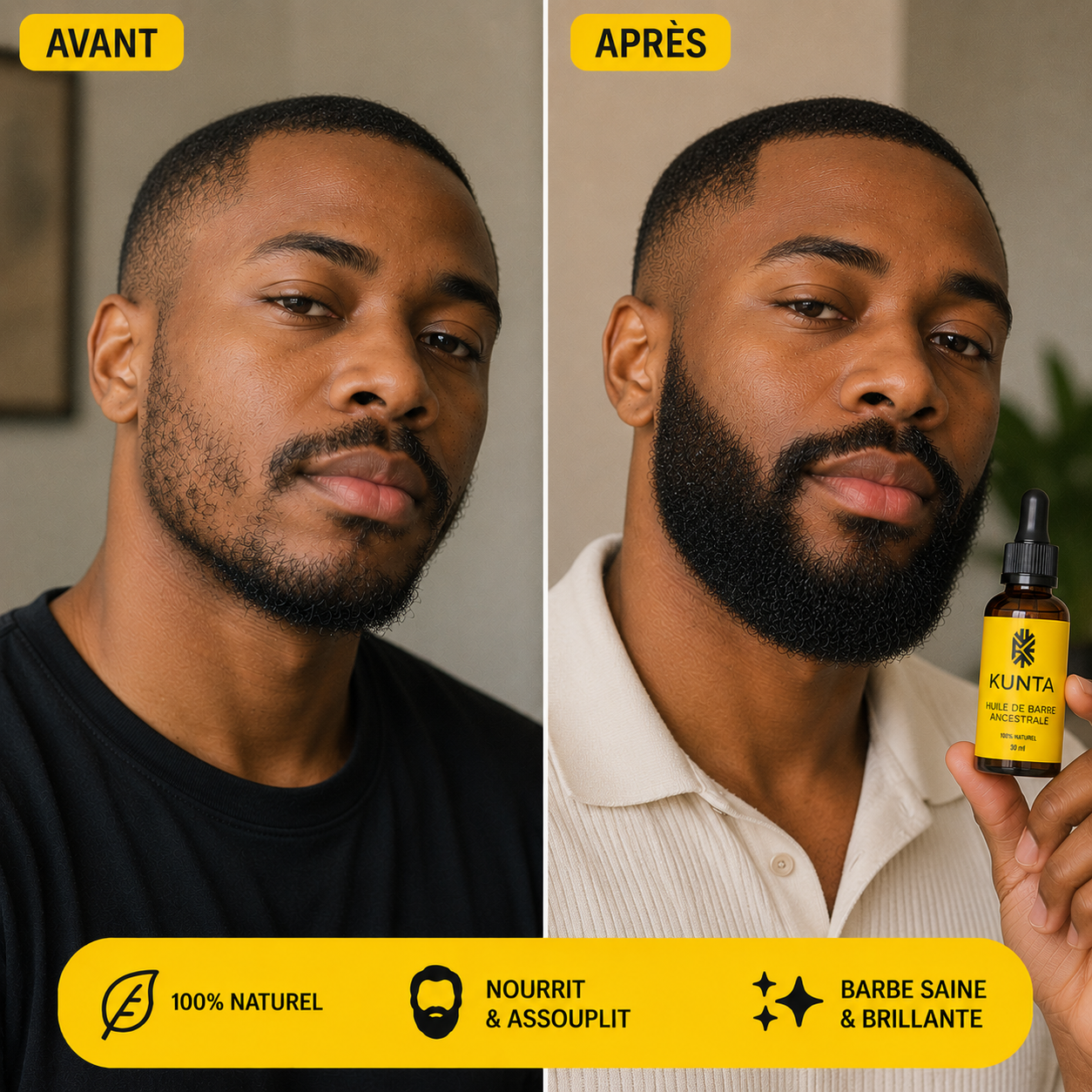 Kunta – Huile de Barbe Croissance ULTRA Rapide (30 ml)